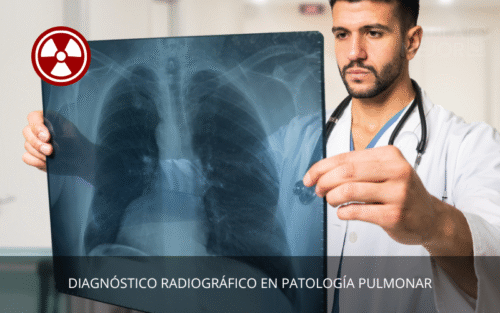 Diagnóstico Radiográfico en Patología Pulmonar