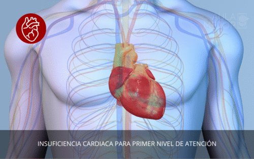 Insuficiencia Cardiaca para Primer Nivel de Atención