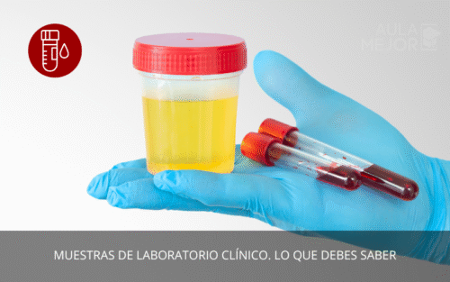 Muestras de Laboratorio Clínico. Lo que debes saber