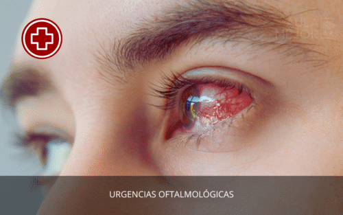 Urgencias Oftalmológicas