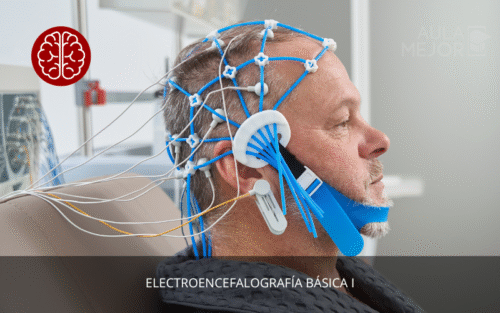 Electroencefalografía Básica I