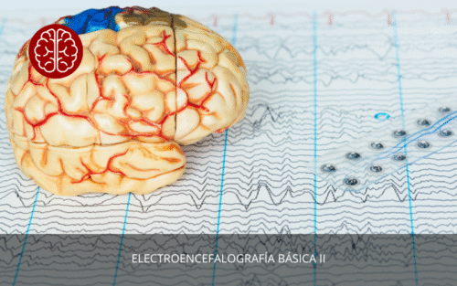 Electroencefalografía Básica II