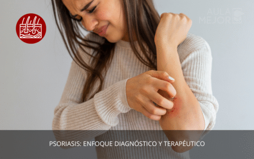 Psoriasis: Enfoque Diagnóstico y Terapéutico