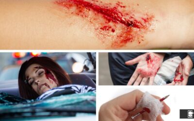 Guía Rápida para la Atención de Heridas y Control de Hemorragias
